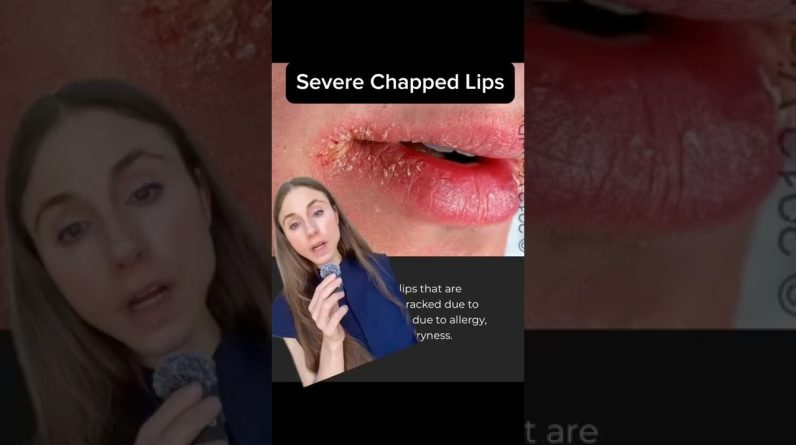 1765246137 maxresdefault