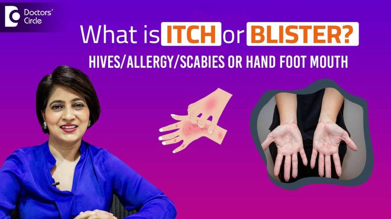 1765249737 maxresdefault