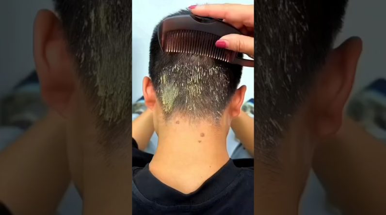 1765269189 maxresdefault