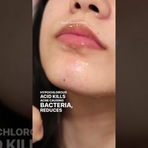 1765275445 maxresdefault