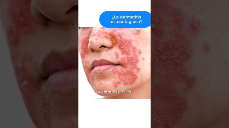 1765305909 maxresdefault