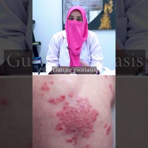 1765308401 maxresdefault