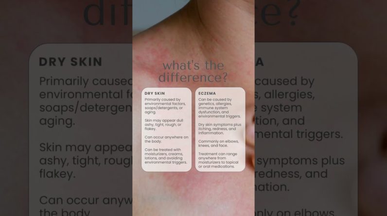 1765309440 maxresdefault