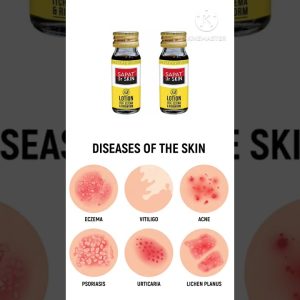 1765319456 maxresdefault