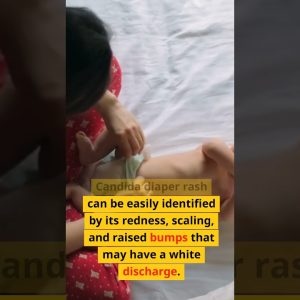 1765327615 maxresdefault