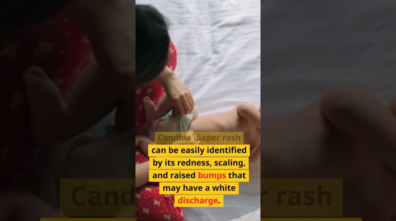 1765327615 maxresdefault