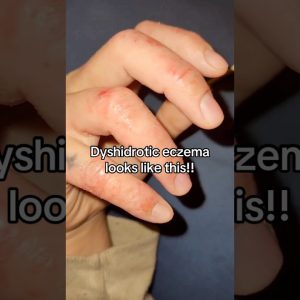 1765333986 maxresdefault