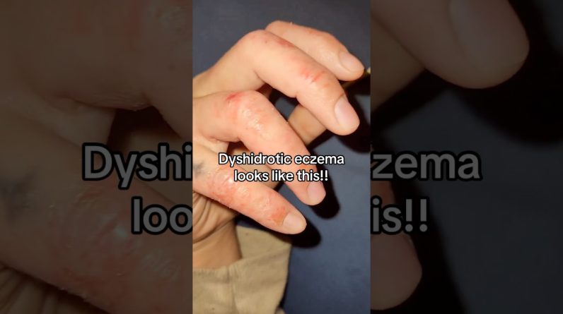 1765333986 maxresdefault