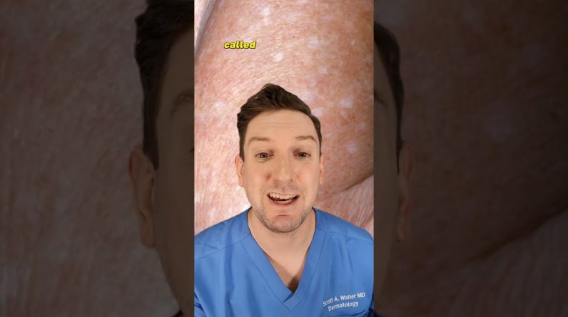 1765346042 maxresdefault