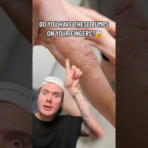 1765348617 maxresdefault