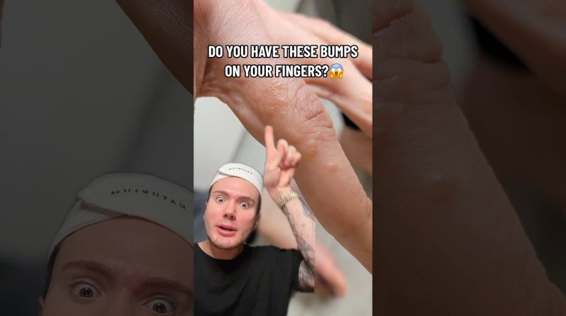 1765348617 maxresdefault