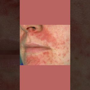 1765349581 maxresdefault