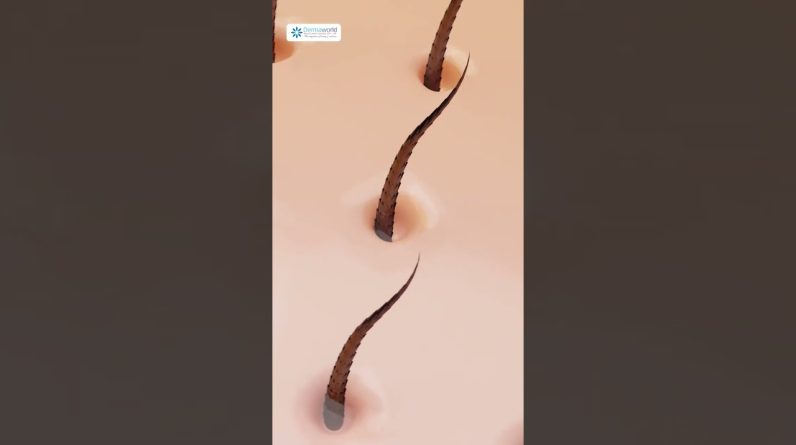 1765349887 maxresdefault