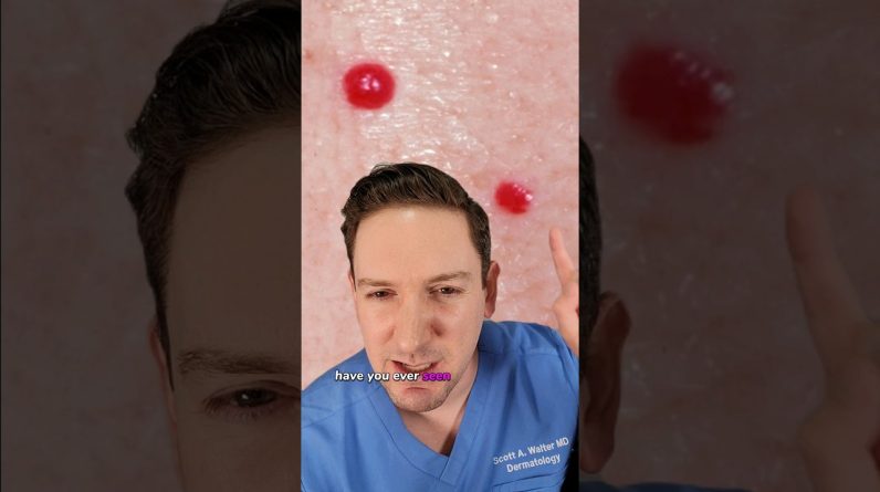 1765357014 maxresdefault