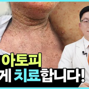 1765365594 maxresdefault