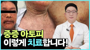 1765365594 maxresdefault