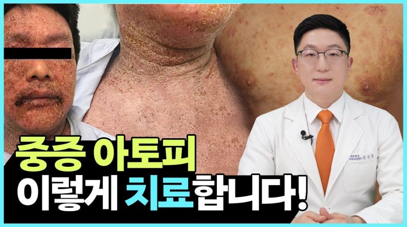 1765365594 maxresdefault