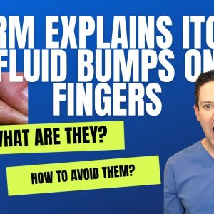 1765385225 maxresdefault