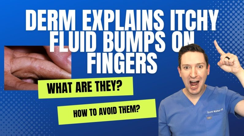 1765385225 maxresdefault