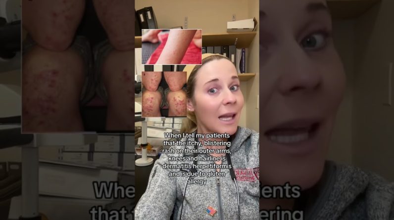 1765388878 maxresdefault