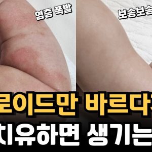 1765391215 maxresdefault