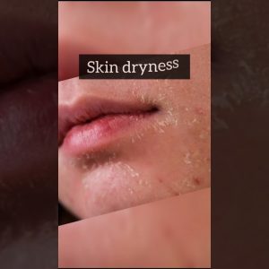 1765396678 maxresdefault