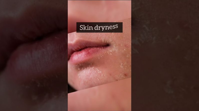 1765396678 maxresdefault