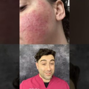 1765401058 maxresdefault