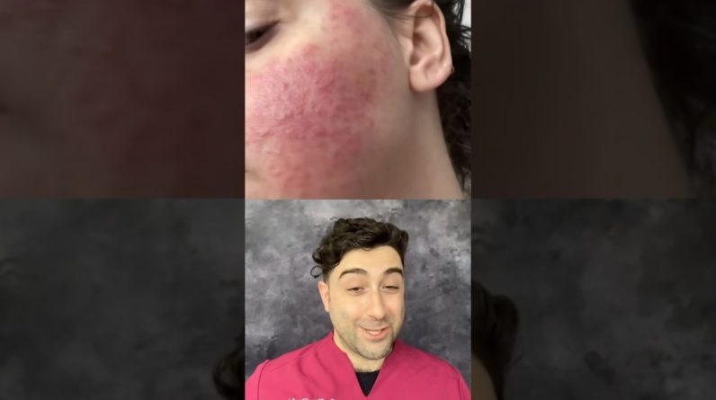 1765401058 maxresdefault