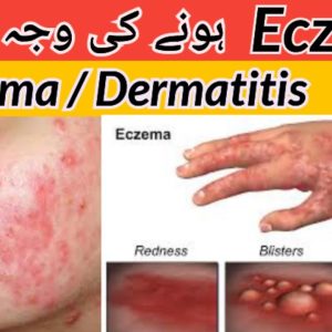 1765404720 maxresdefault