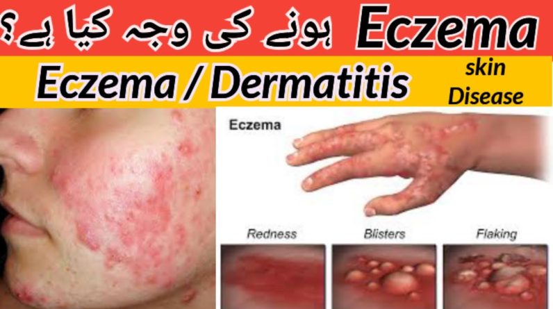 1765404720 maxresdefault