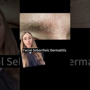 1765422896 maxresdefault