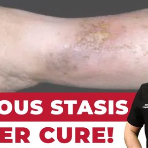 1765425533 maxresdefault