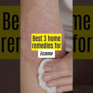 1765431501 maxresdefault