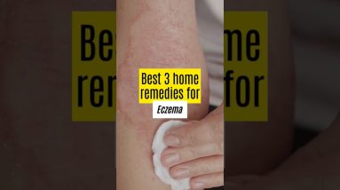 1765431501 maxresdefault