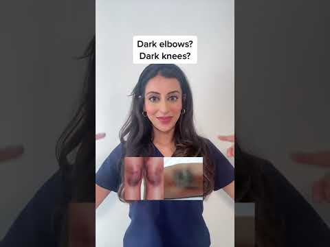 1765434050 hqdefault