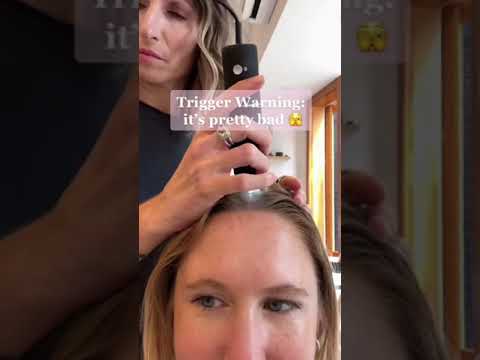 1765451196 hqdefault