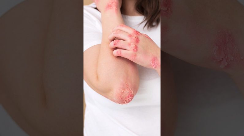 1765452411 maxresdefault