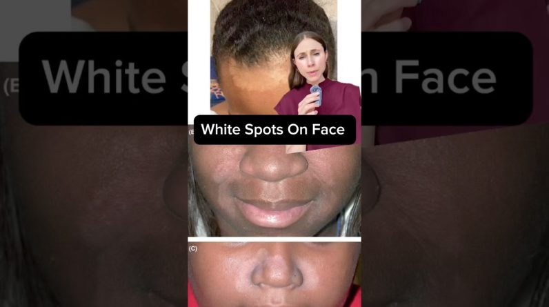 1765456101 maxresdefault