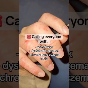 1765462206 maxresdefault