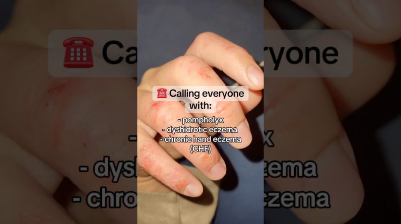 1765462206 maxresdefault