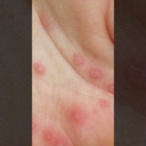 1765469499 maxresdefault