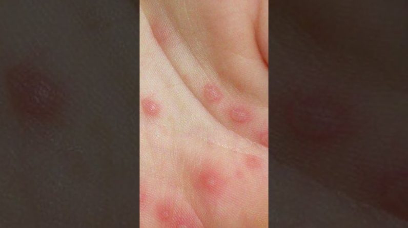 1765469499 maxresdefault