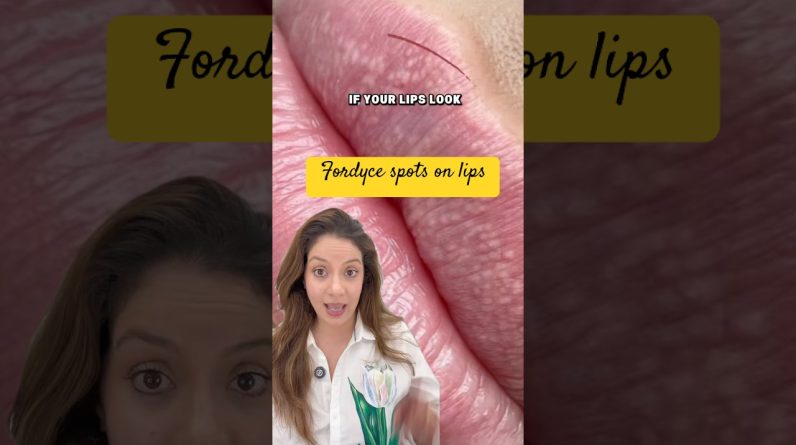 1765473182 maxresdefault