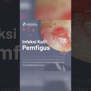 1765487820 maxresdefault