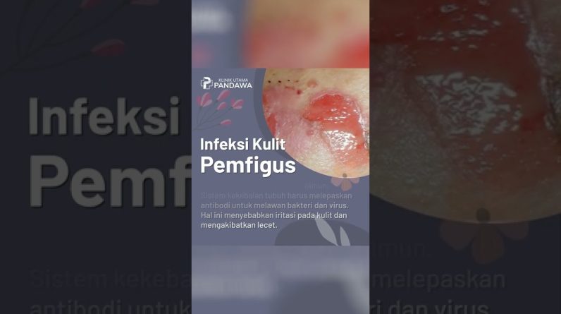 1765487820 maxresdefault