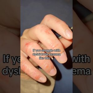 1765491486 maxresdefault