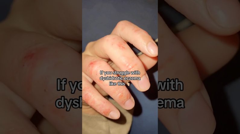 1765491486 maxresdefault