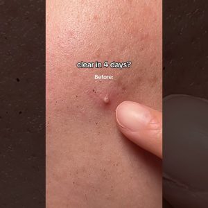 1765491908 maxresdefault