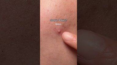 1765491908 maxresdefault